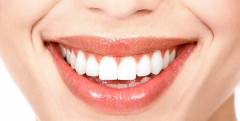 Lentes de contato para os dentes: posso usar?