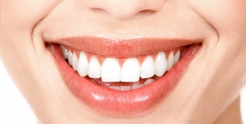 Lentes de contato para os dentes: posso usar?