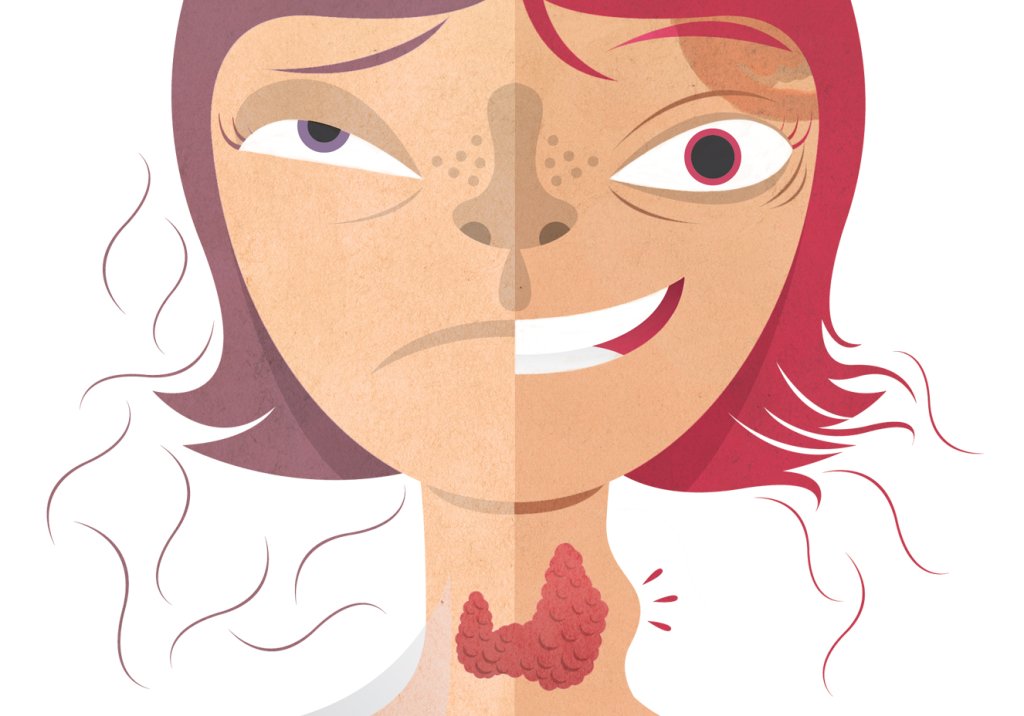 Quais são os primeiros sinais do aumento da tireoide?