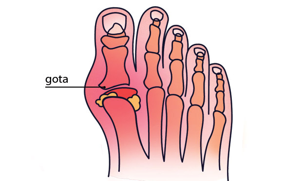 9. Ácido úrico 9. Ácido úrico
