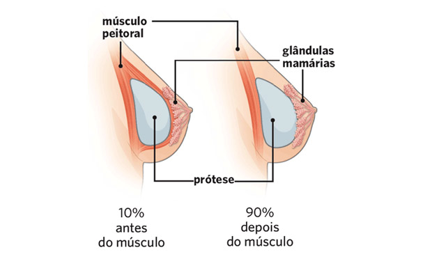 1. Procedimento 1. Procedimento