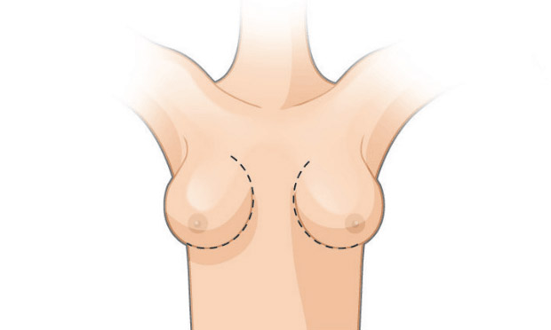 2. Marca e Corta 2. Marca e Corta