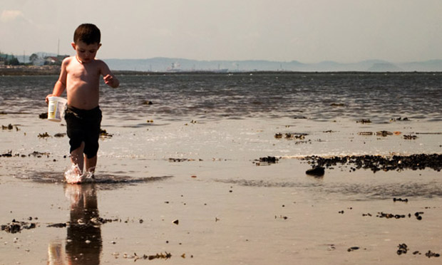 Conjuntivite Conjuntivite