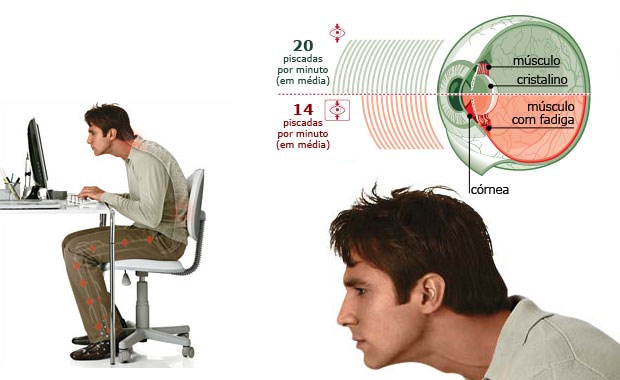 Infográfico Infográfico