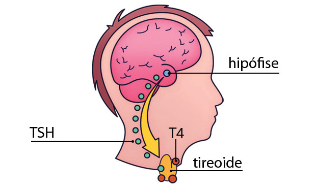7. TSH e T4 7. TSH e T4
