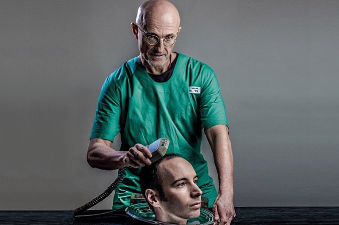 O médico que promete fazer um transplante de cabeça em 2017