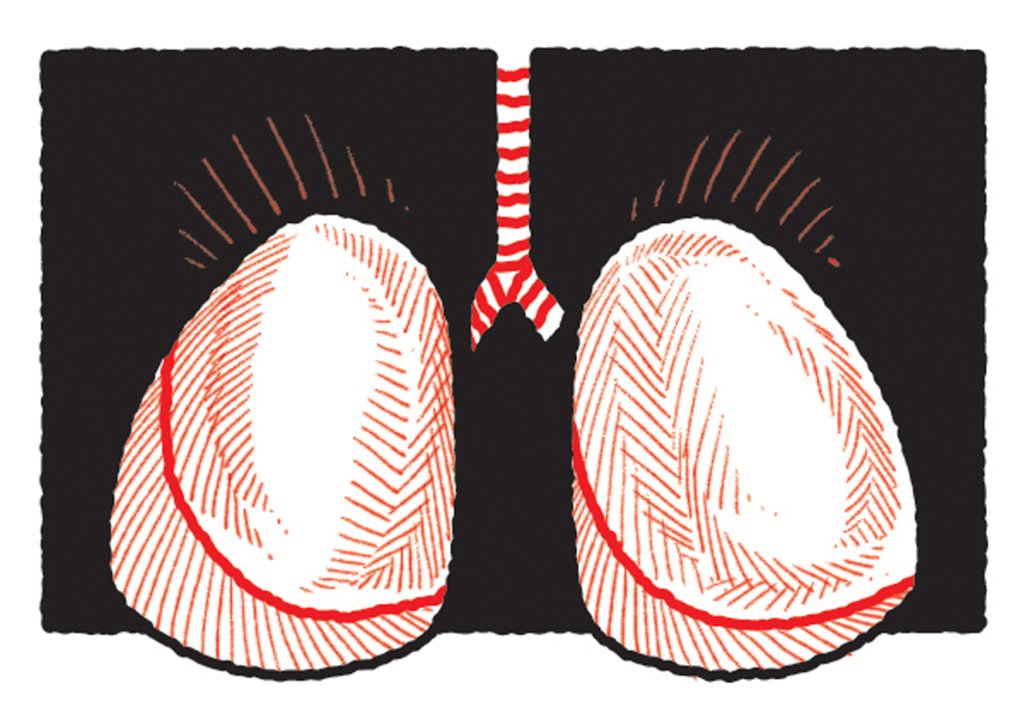 Novo medicamento reduz risco de morte por hipertensão arterial pulmonar