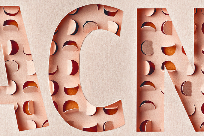 As doenças de pele que mais abalam o bem-estar