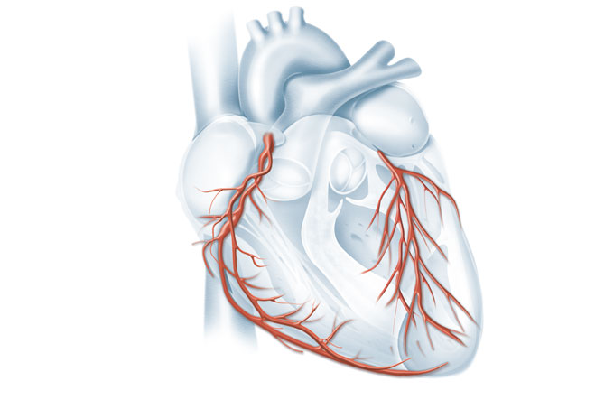 Stents não aliviam a dor no peito?