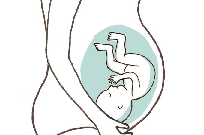 Por que nem toda gestante com zika tem filhos com microcefalia