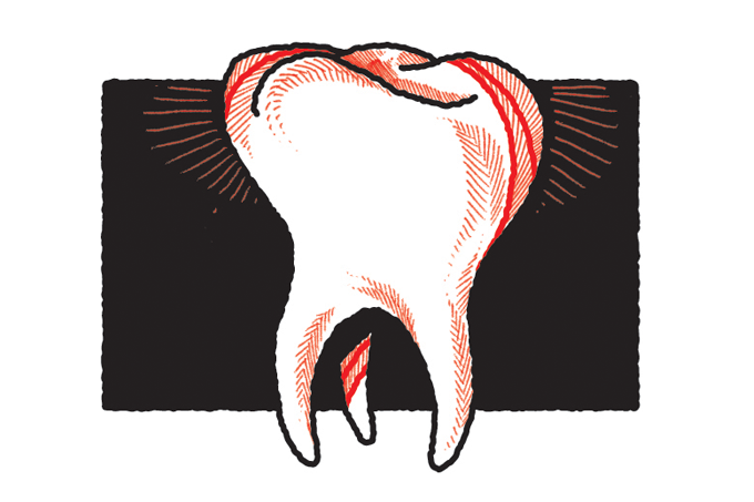 Como aliviar dor de dente