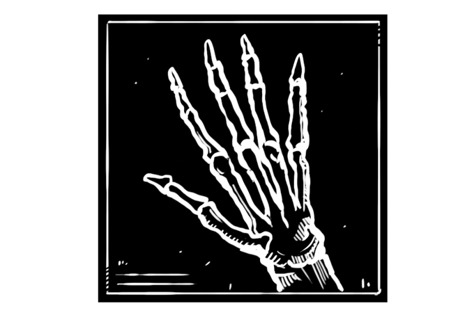 Reumatologia: da cortisona à medicina de precisão, 70 anos de evolução