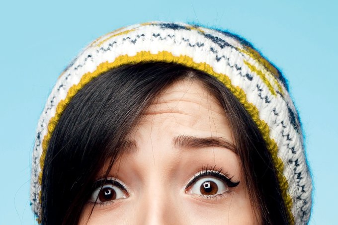 Caspa no inverno: da prevenção ao tratamento do cabelo