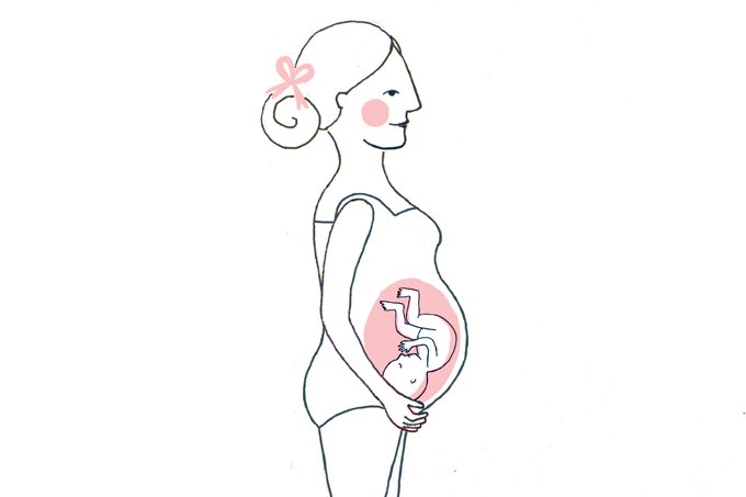 Um movimento pelo parto mais adequado a cada mulher