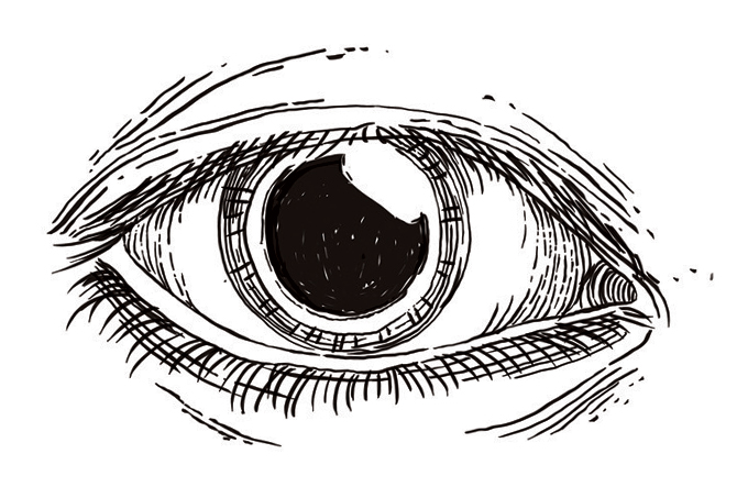 o que é ceratocone nos olhos? causas e cura?