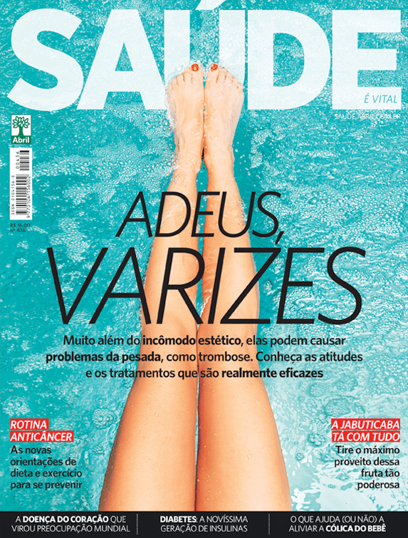 Atitudes e tratamentos contra as varizes - 01/11/2018