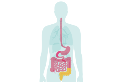 o que é a doença de crohn