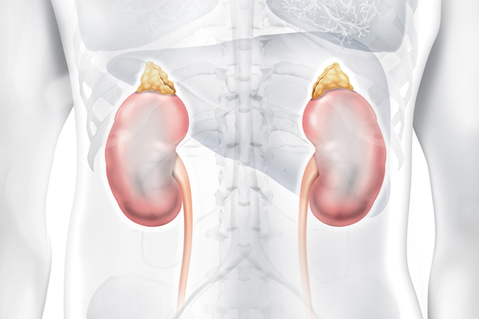 gota causa doença renal cronica