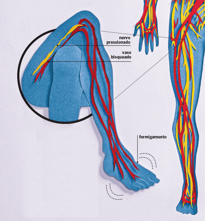 O que acontece quando o braço ou a perna formigam?