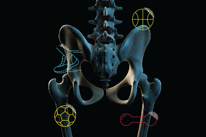 exercício para osteoporose