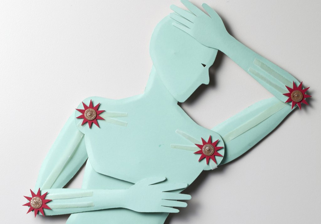 Coronavírus: quais cuidados pacientes com doenças reumatológicas devem ter