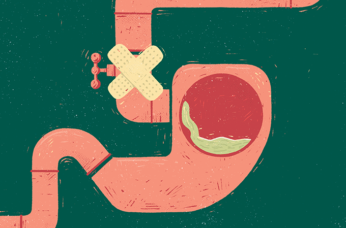 Refluxo não é tudo igual: nova classificação melhora tratamento