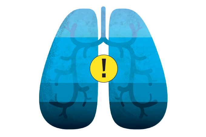 Desenho de pulmões azuis com ponto de exclamação no meio