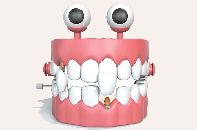 A última geração dos implantes dentários