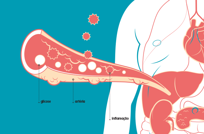 ilustração de moléculas inflamatórias pelas artérias