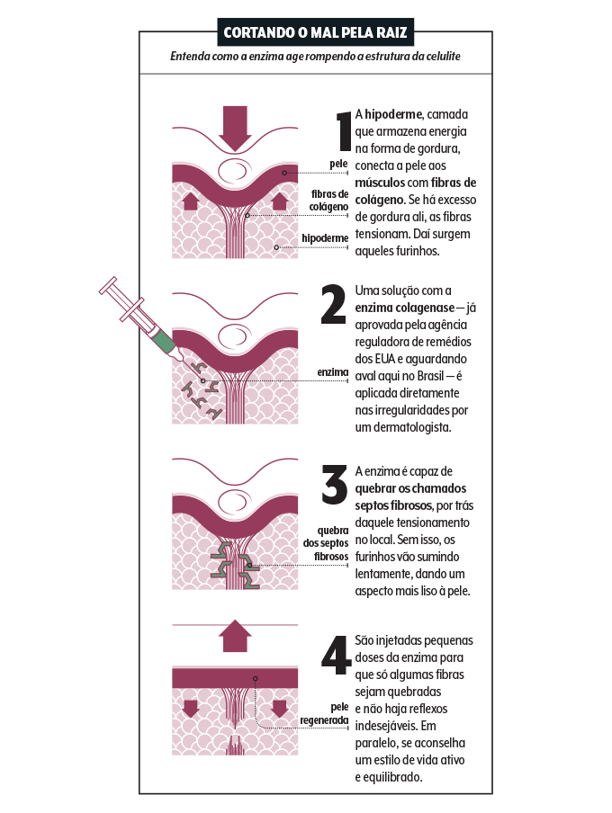 Infográfico