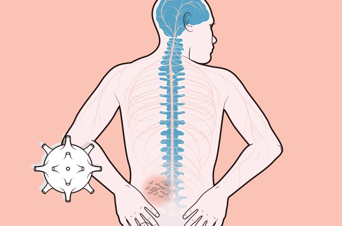 Diabetes e herpes-zóster: do controle da glicose à vacinação