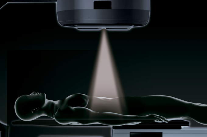 Mistério do câncer: cientistas desvendam detalhe poderoso da radioterapia