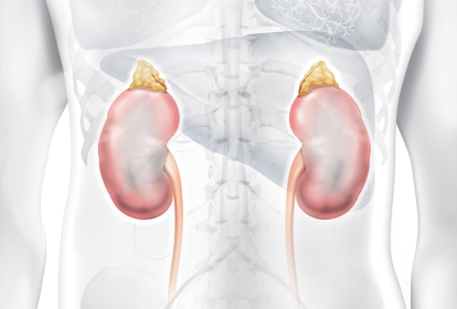 doença renal