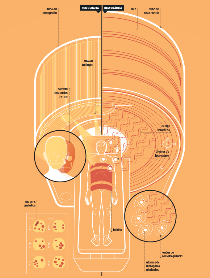 como funciona ressonância magnética e a tomografia computadorizada