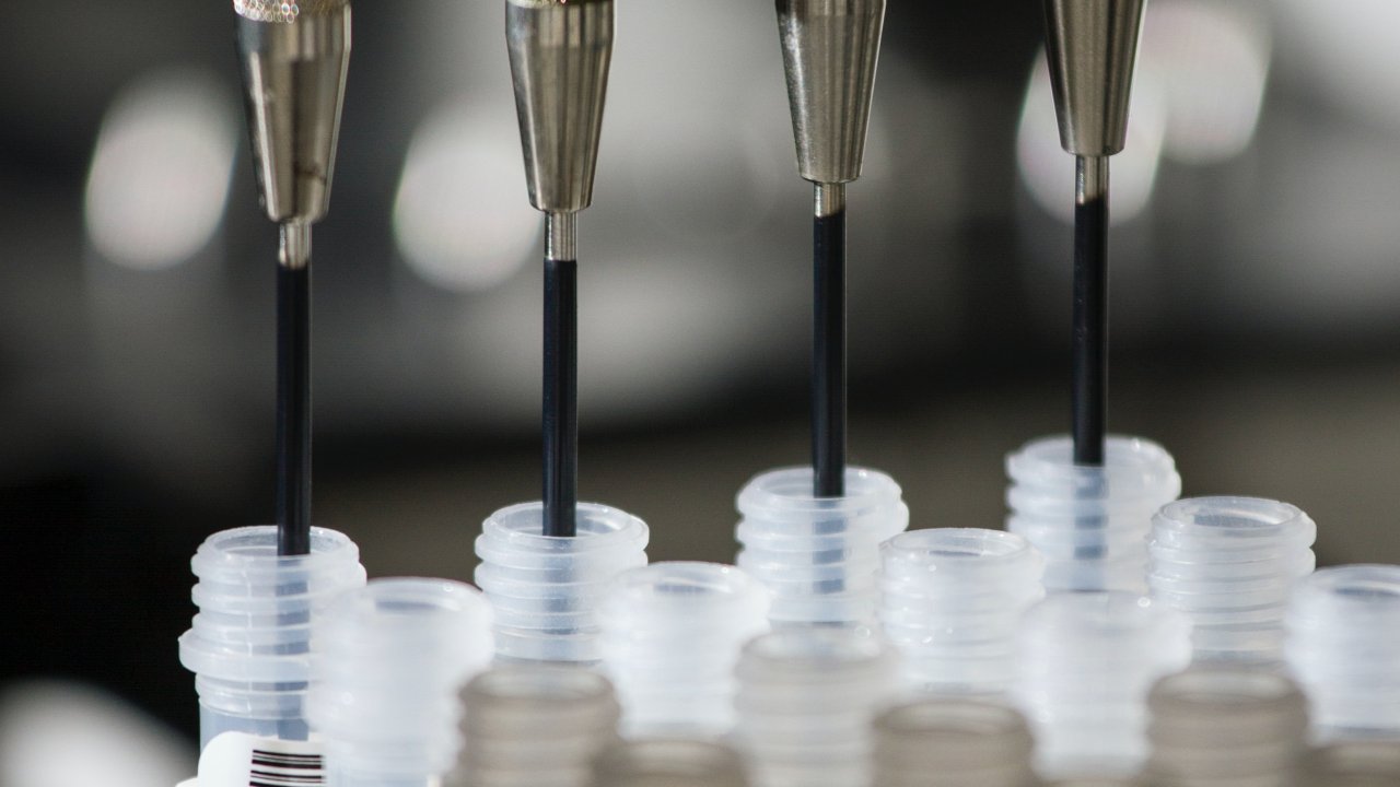 Foto de pipetas, simbolizando exame para câncer