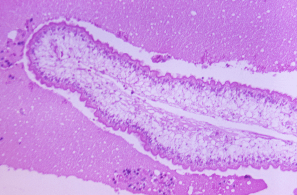 Albendazol: para que serve, como tomar e quais os efeitos colaterais?