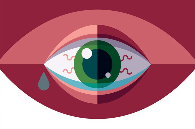 Terçol: o que é, sintomas, causas e tratamento