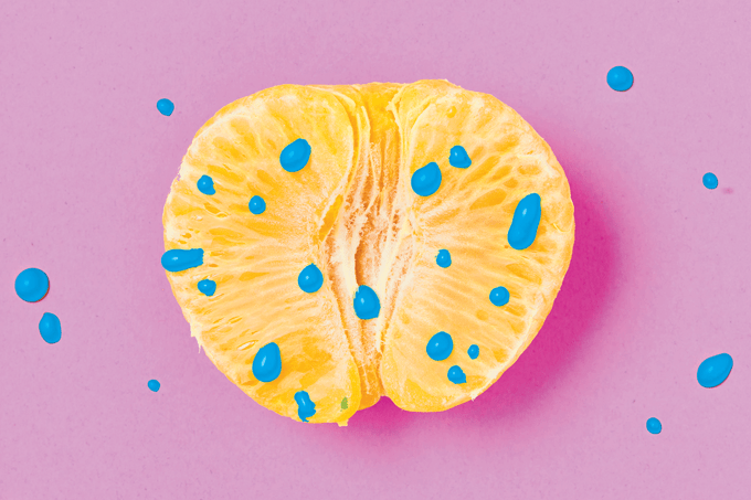 Sífilis congênita ainda é um desafio no Brasil