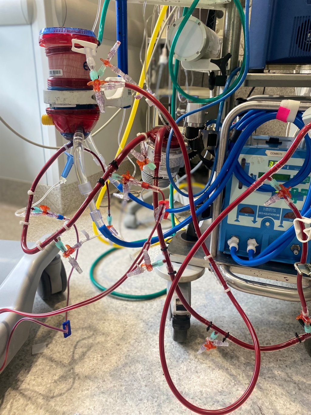 Você já ouviu falar em ECMO e como ela pode ajudar a salvar vidas?