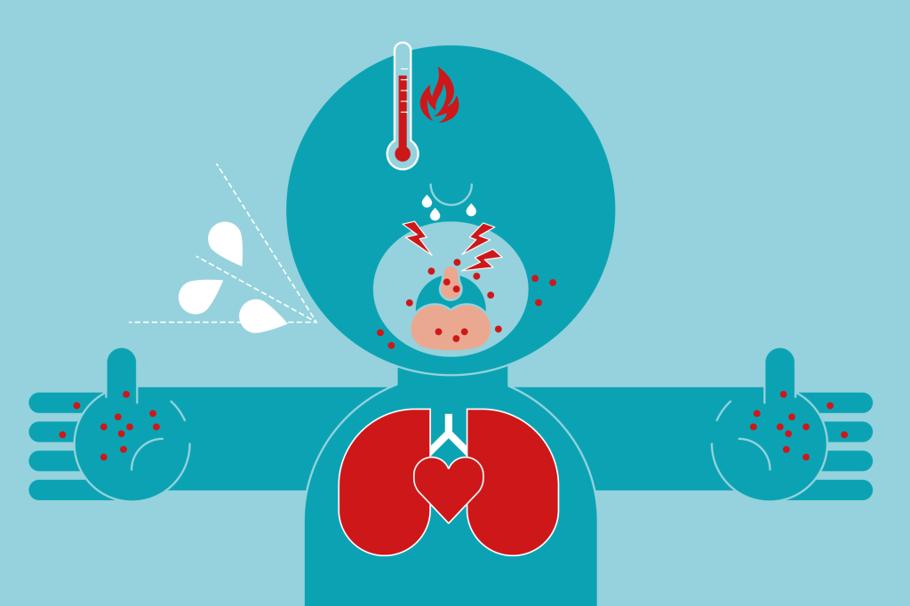 Alta de casos da doença mão-pé-boca: como se pega e como tratar