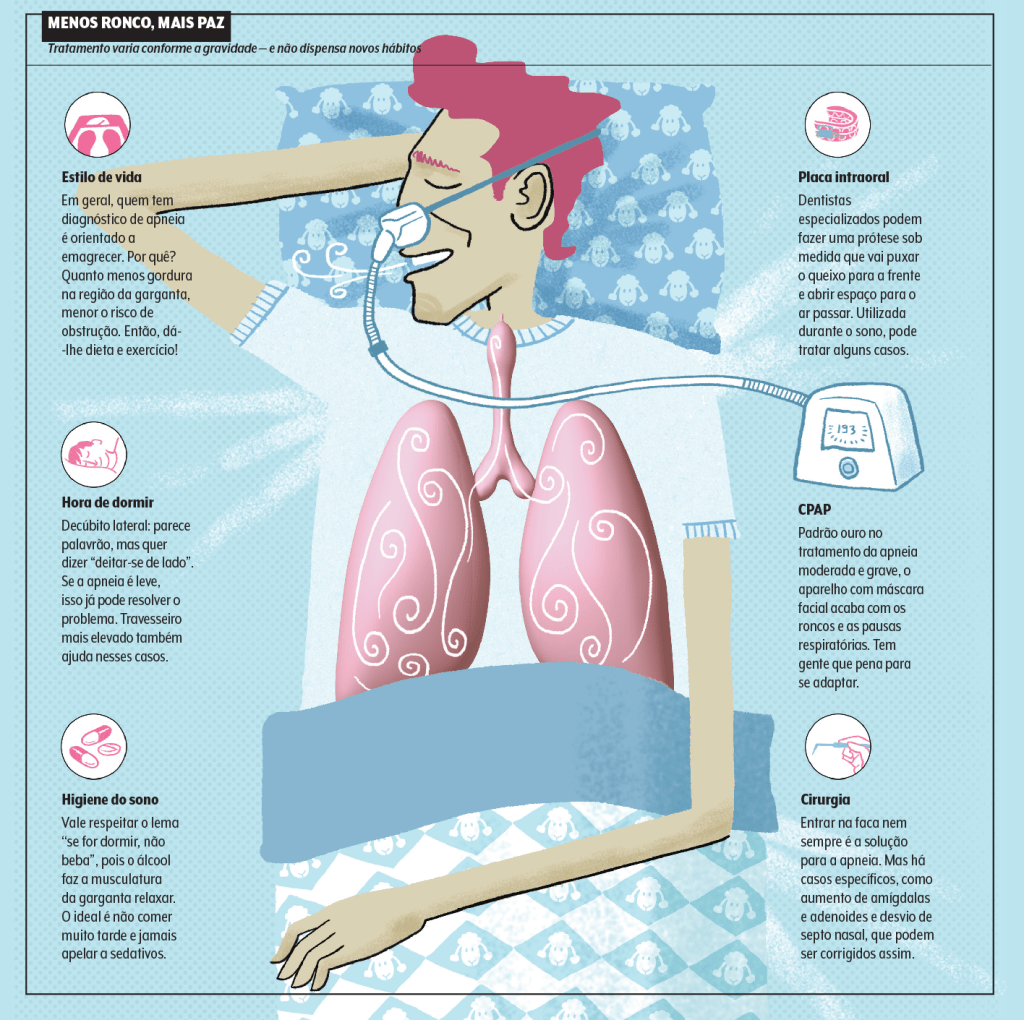 Apneia do Sono: soluções