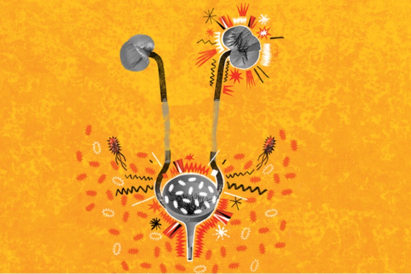 Infecção urinária: o que é, os sintomas e o tratamento