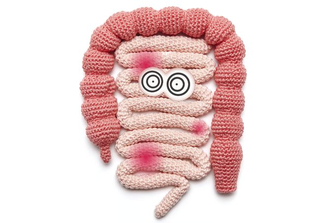 Constipação intestinal: por que o intestino não funciona como deveria?