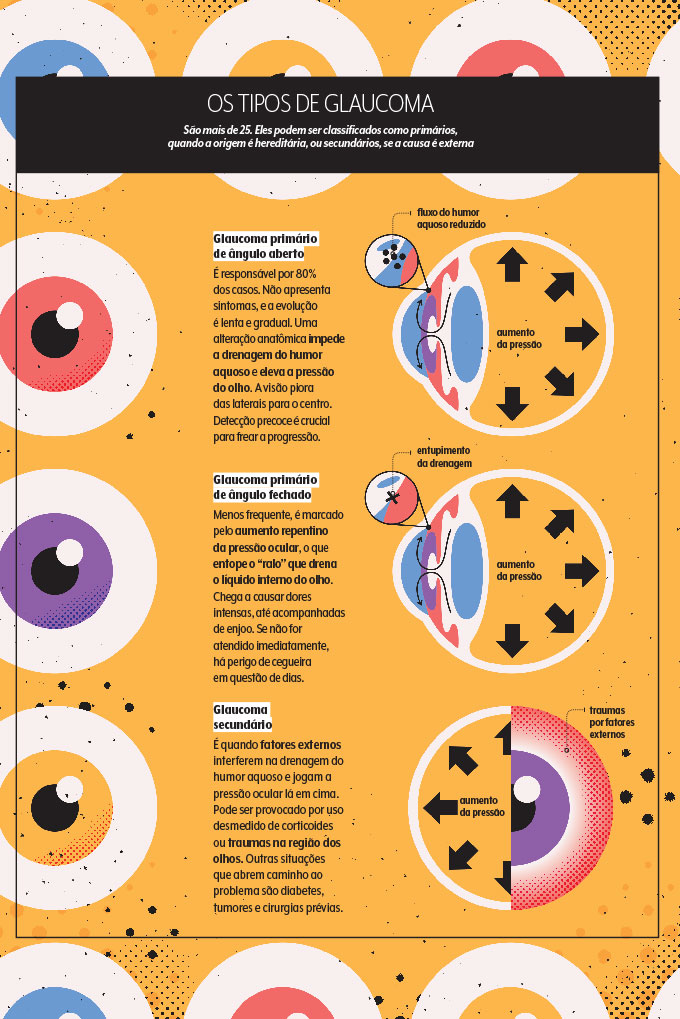 glaucoma