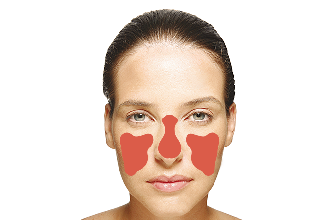 Lúpus: quando o organismo luta contra ele próprio