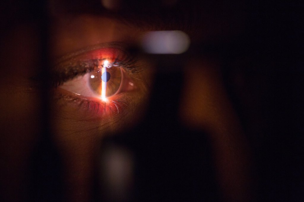 Exame dos olhos poderá ajudar a prever o risco de derrame