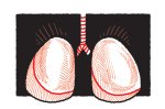 poluicao-pneumonia