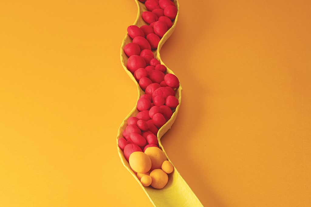 Lp(a): o que é, como controlar e quais as metas para esse tipo perigoso de colesterol