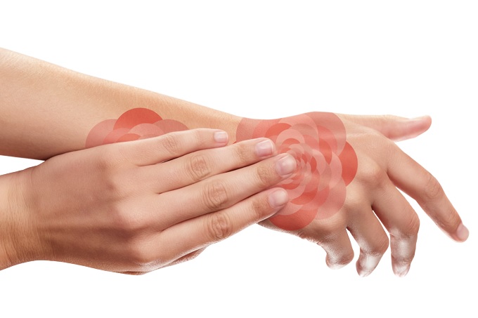 A psoríase faz parte de mim, mas não me define