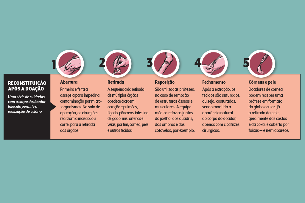 496-materia-doacao-orgaos-quadro-reconstituicao